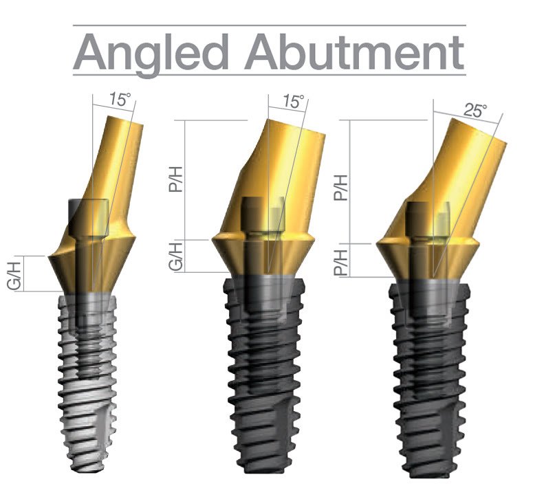 IS Angled Abutment 15Â°